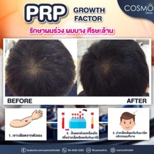 PRPreview hair1