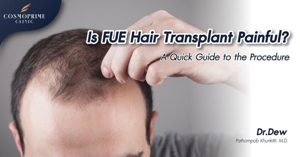 Is FUE Hair Transplant Painful?
