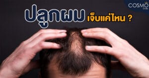 ปลูกผมเจ็บแค่ไหน-01