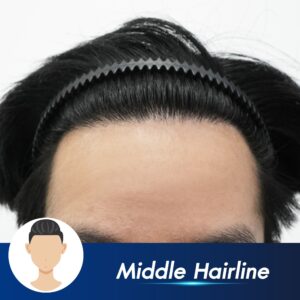 hairline