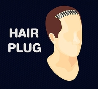 hair plug