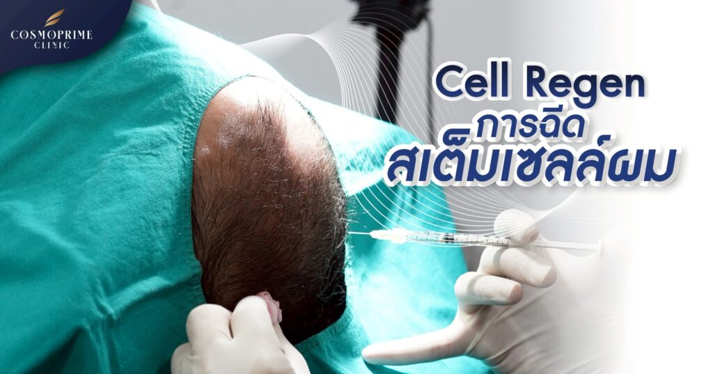 Cell regen