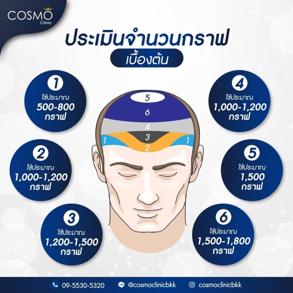 กราฟผม