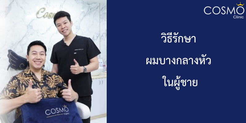 วิธีรักษา ผมบางกลางหัวในผู้ชาย