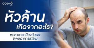 หัวล้านเกิดจากอะไร