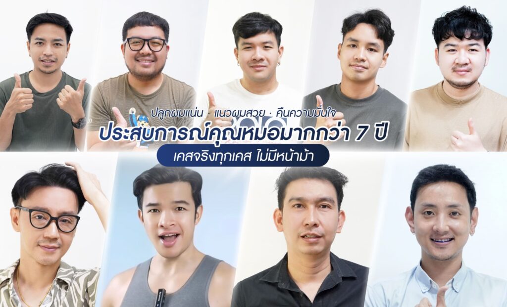 รีวิวปลูกผม