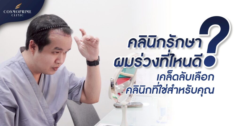 คลินิกผมร่วง