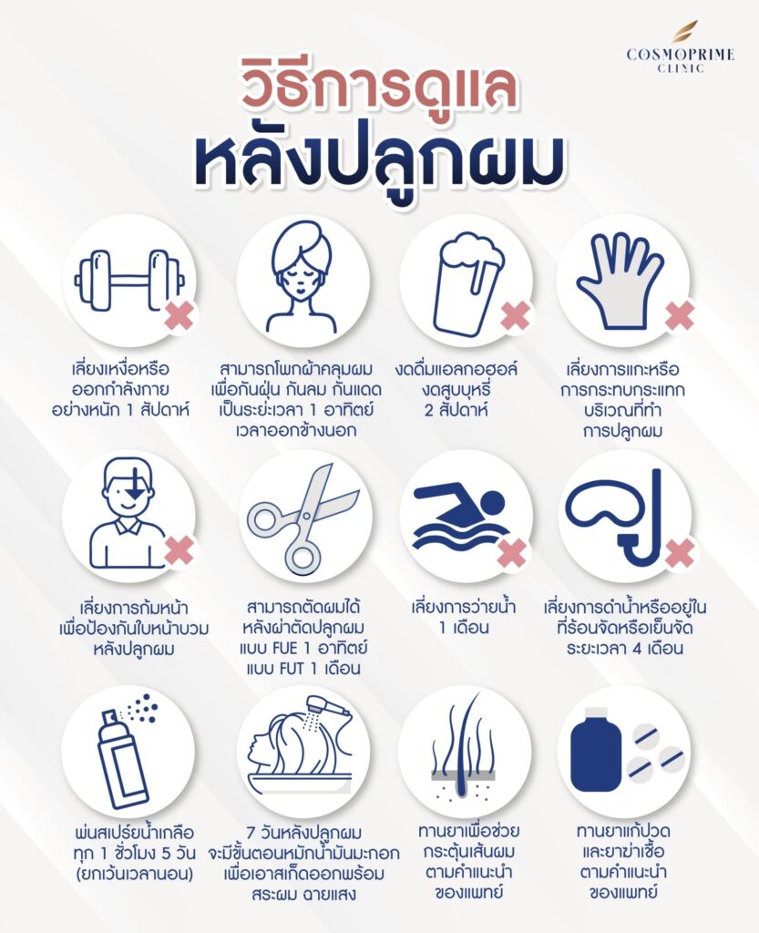 หลังปลูกผมยาว