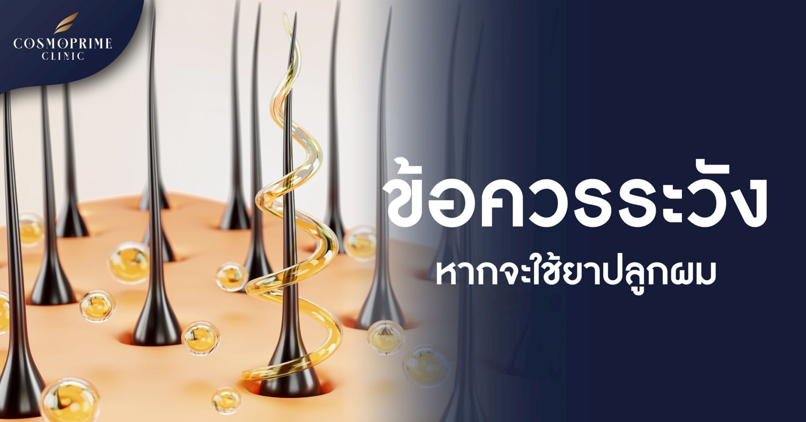 ยาปลูกผม ยี่ห้อไหนดี