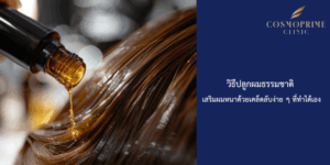 วิธีปลูกผมธรรมชาติ