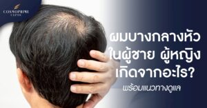 ผมบางกลางหัว