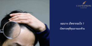 ผมบาง เกิดจากอะไร