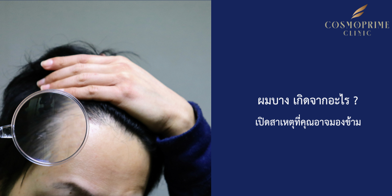 ผมบาง เกิดจากอะไร