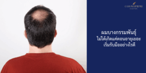 ผมบางกรรมพันธุ์