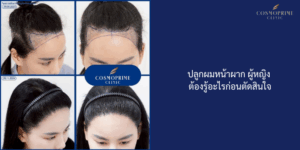 ปลูกผมหน้าผาก ผู้หญิง